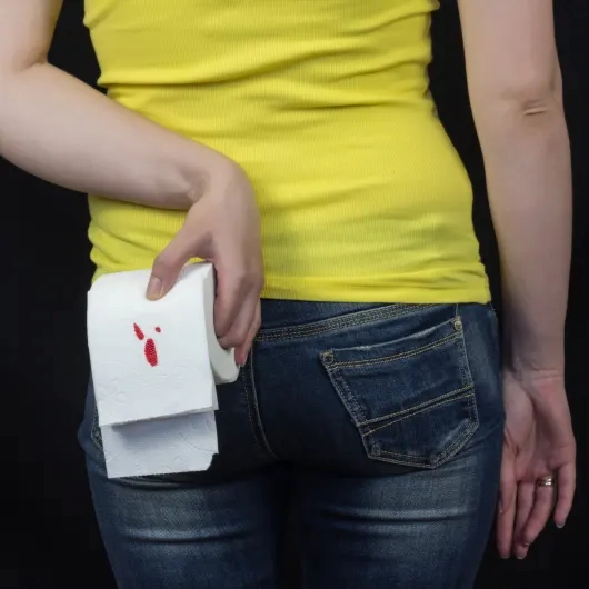 Anal Fissure Symptoms