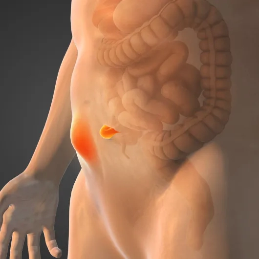 Ventral Hernia Types