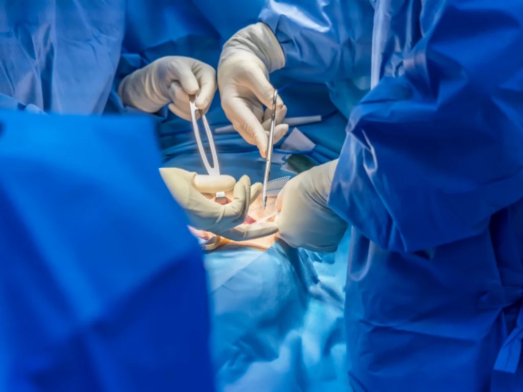Hernia Surgery Singapore