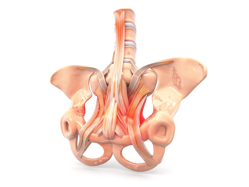 Total Pelvic Exenteration